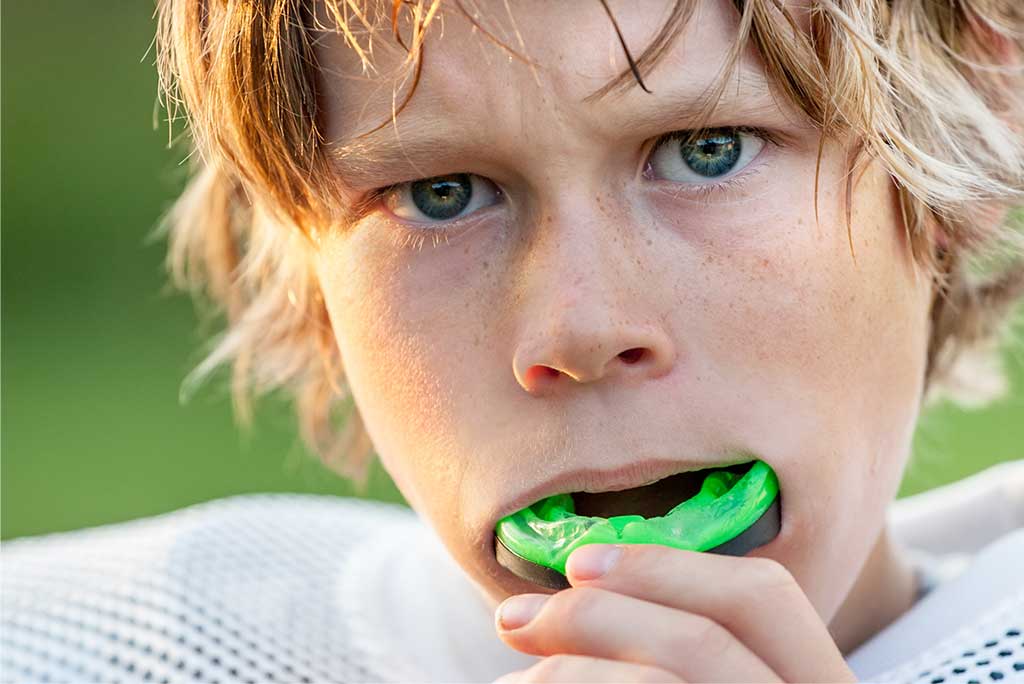 does my child need a mouthguard for sports