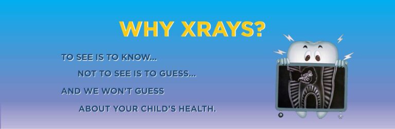are dental x-rays safe