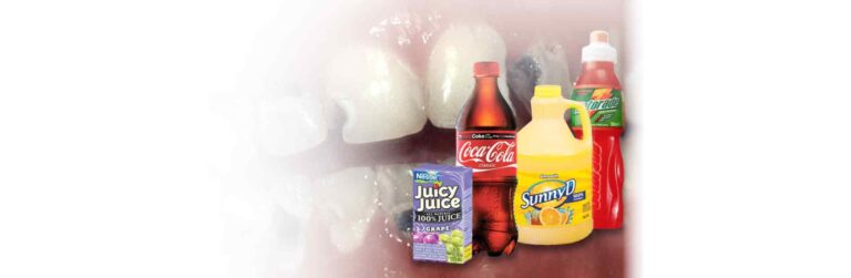 Drinks & foods that can harm teeth